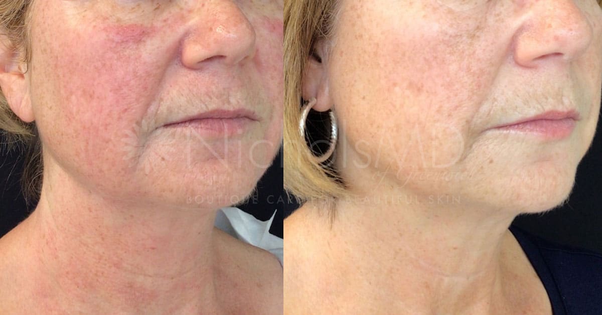 NicholsMD of Greenwich Greenwich Secret Treatment