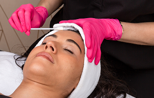 Advanced Corrective Chemical Peel
