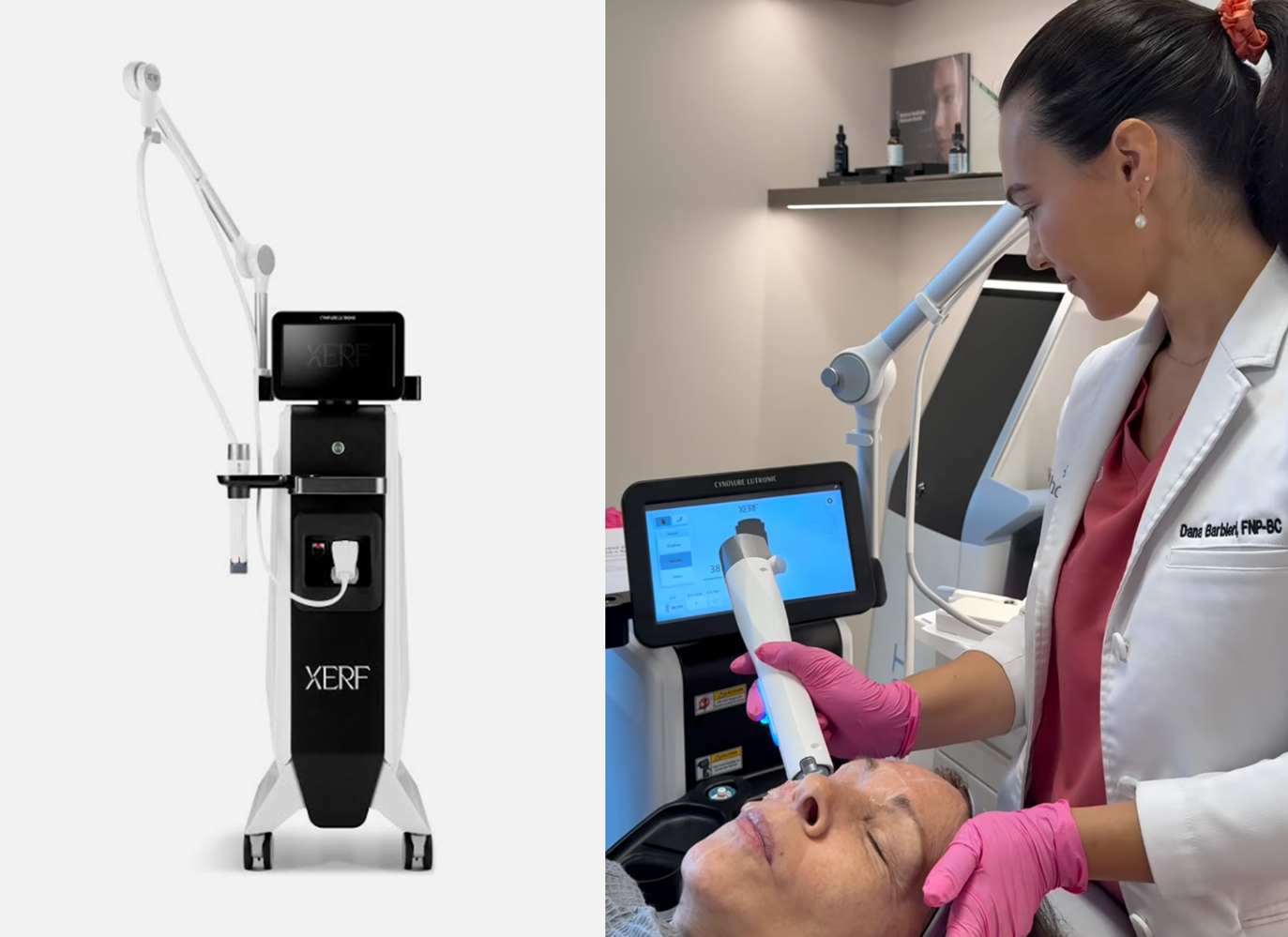 NicholsMD XERF treatment device in use